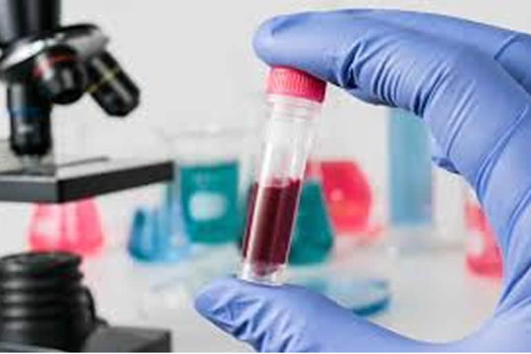 efectuan-curso-en-linea-sobre-enfermedades-hematologicas-2.jpg
