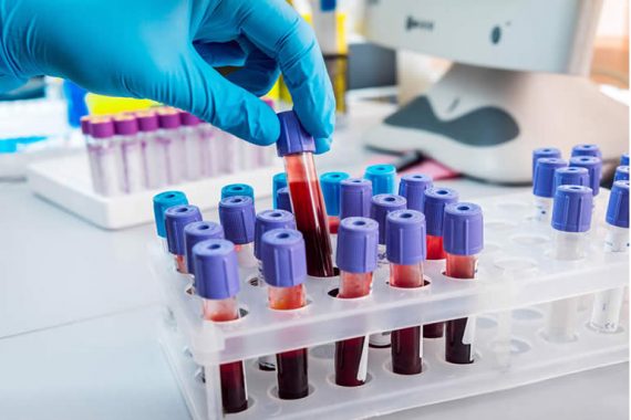 efectuan-curso-en-linea-sobre-enfermedades-hematologicas1.jpg