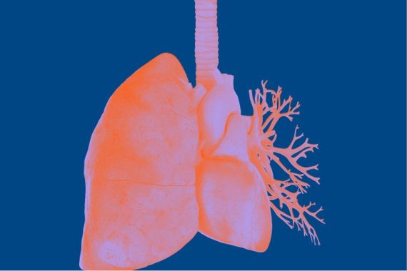 johnson-johnson-lanza-terapia-para-cancer-de-pulmon-avanzado1.jpg